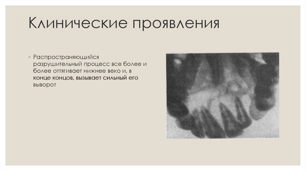 Клинические проявления