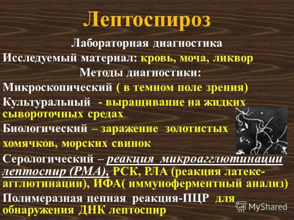 Лептоспироз это. Лабораторная диагностика лептоспироза. Метод диагностики лептоспироза. Лептоспироз материал для исследования. Лептоспироз диагноз.