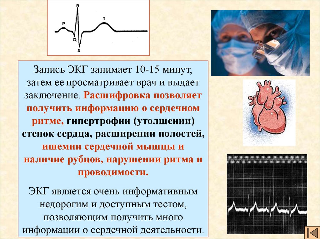 Электрокардиография сердца