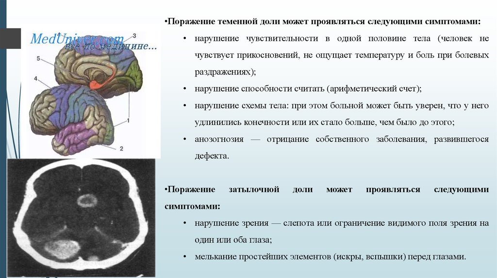 Расстройство схемы тела отмечается при поражении