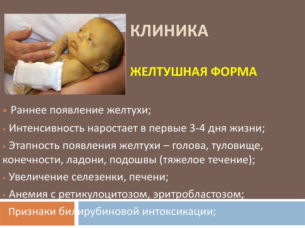 Желтушка у новорожденных дома. Физиологическая желтуха новорожденных билирубин. Гемолитическая болезнь новорождённых желтушная. Физиологическая гемолитическая желтуха новорожденных. Гемолитическая болезнь новорожденных желтуха.