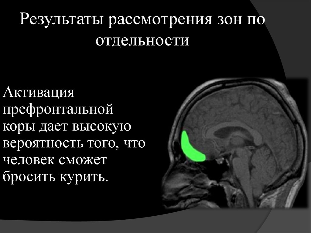 Результаты рассмотрения зон по отдельности