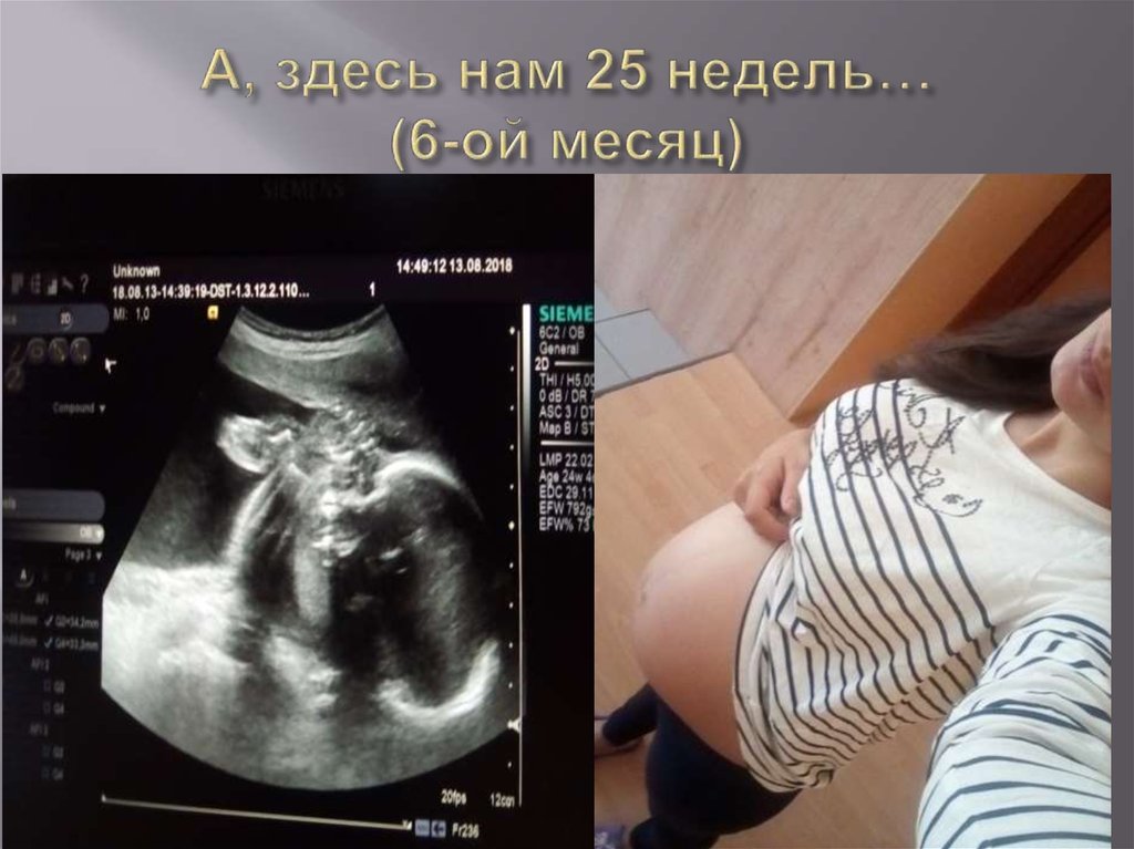 А, здесь нам 25 недель… (6-ой месяц)