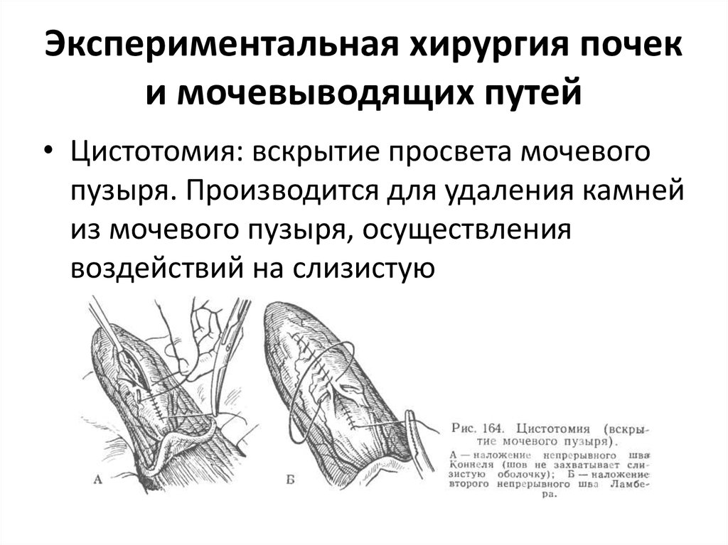 Презентация заболевания почек и мочевыводящих путей