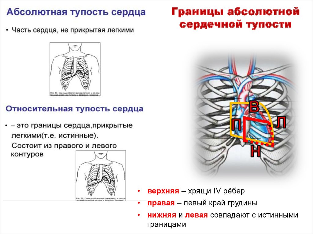 Определение абсолютной тупости сердца