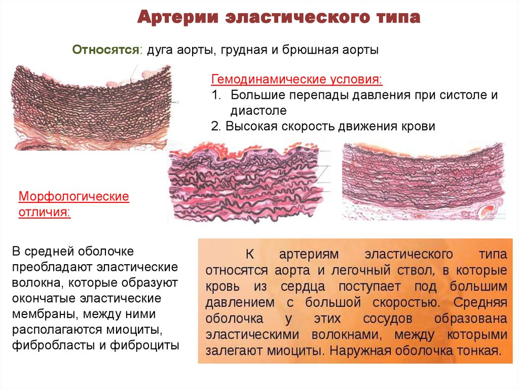 Артерии эластического типа гистология рисунок