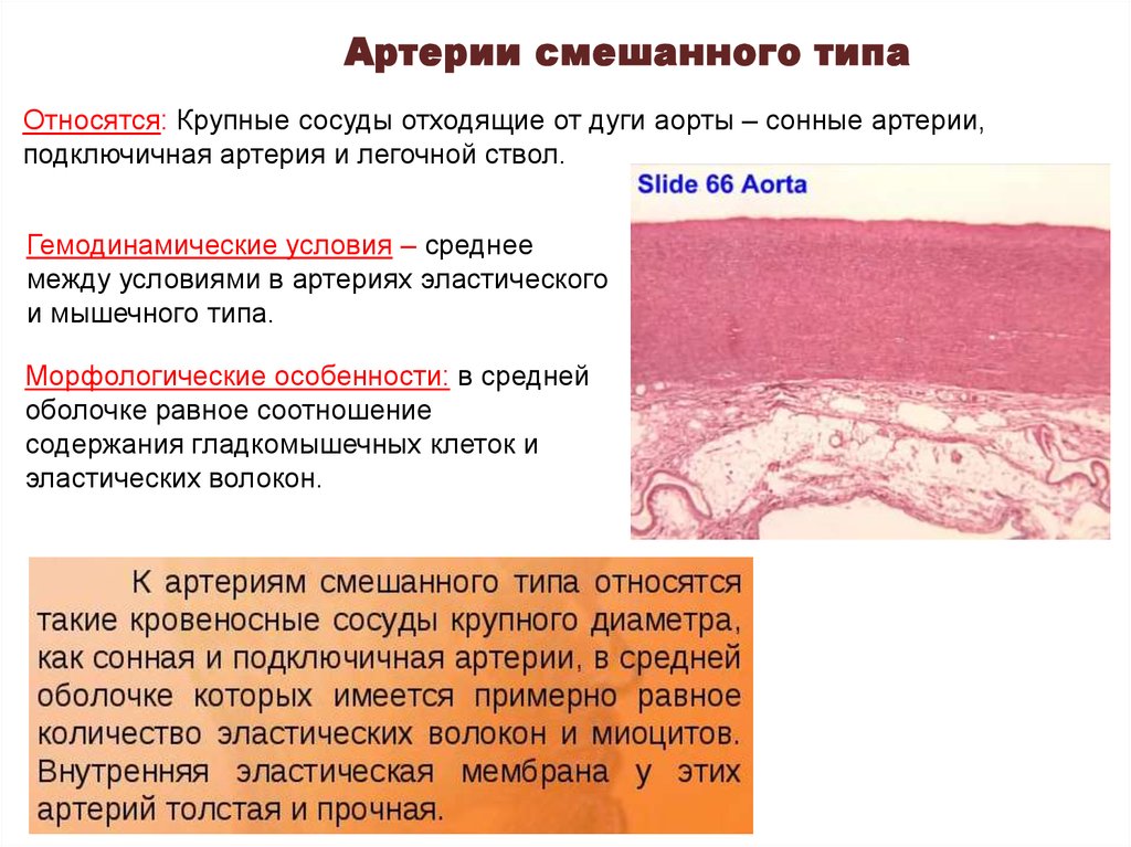 Артерии эластического типа гистология рисунок