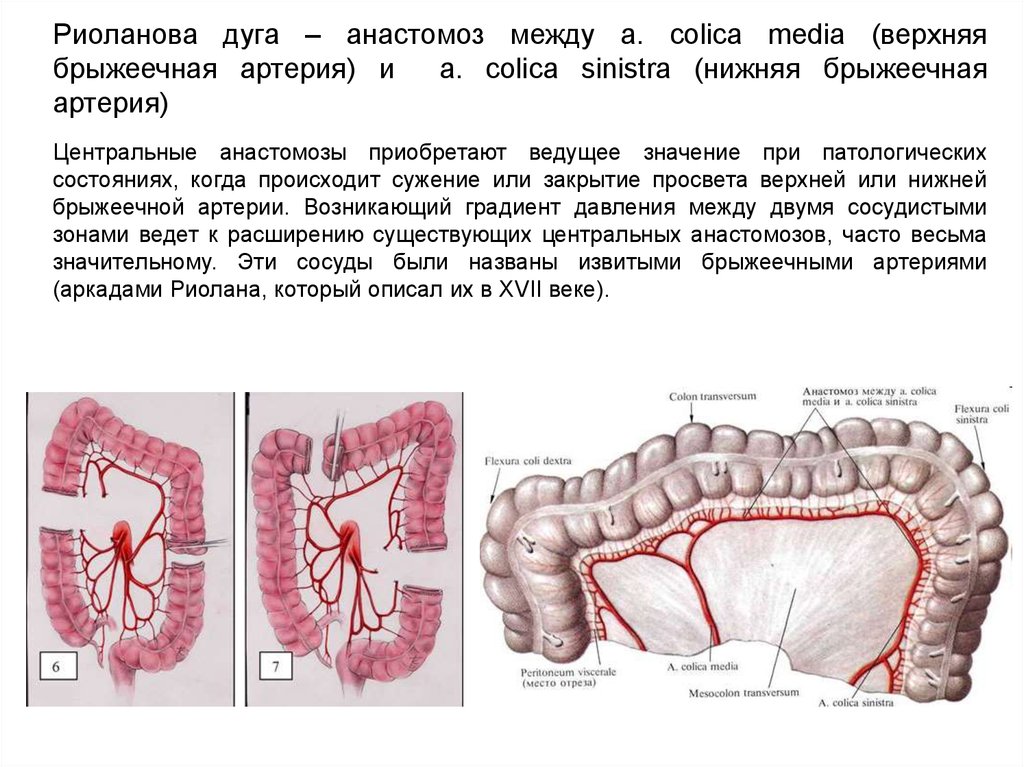 Сужение на латыни. Анастомозы верхней и нижней брыжеечной артерии. Артерия Драммонда и дуга Риолана. Риоланова дуга анатомия. Кровоснабжение верхней брыжеечной артерии.