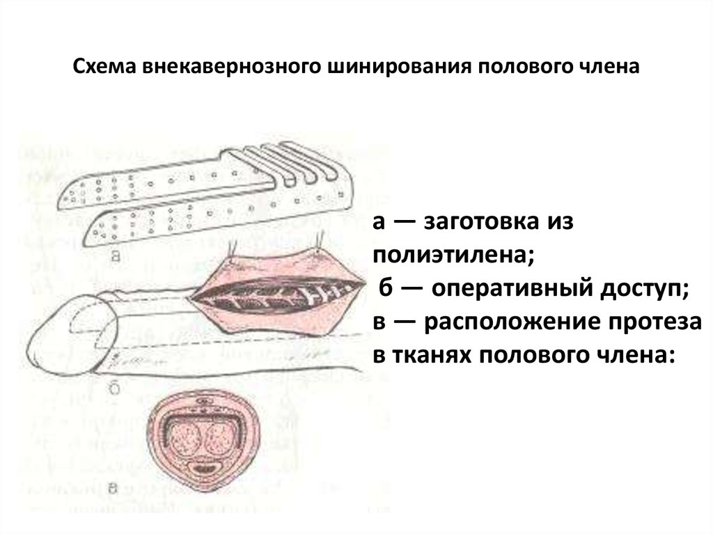 Схема разреза полового члена