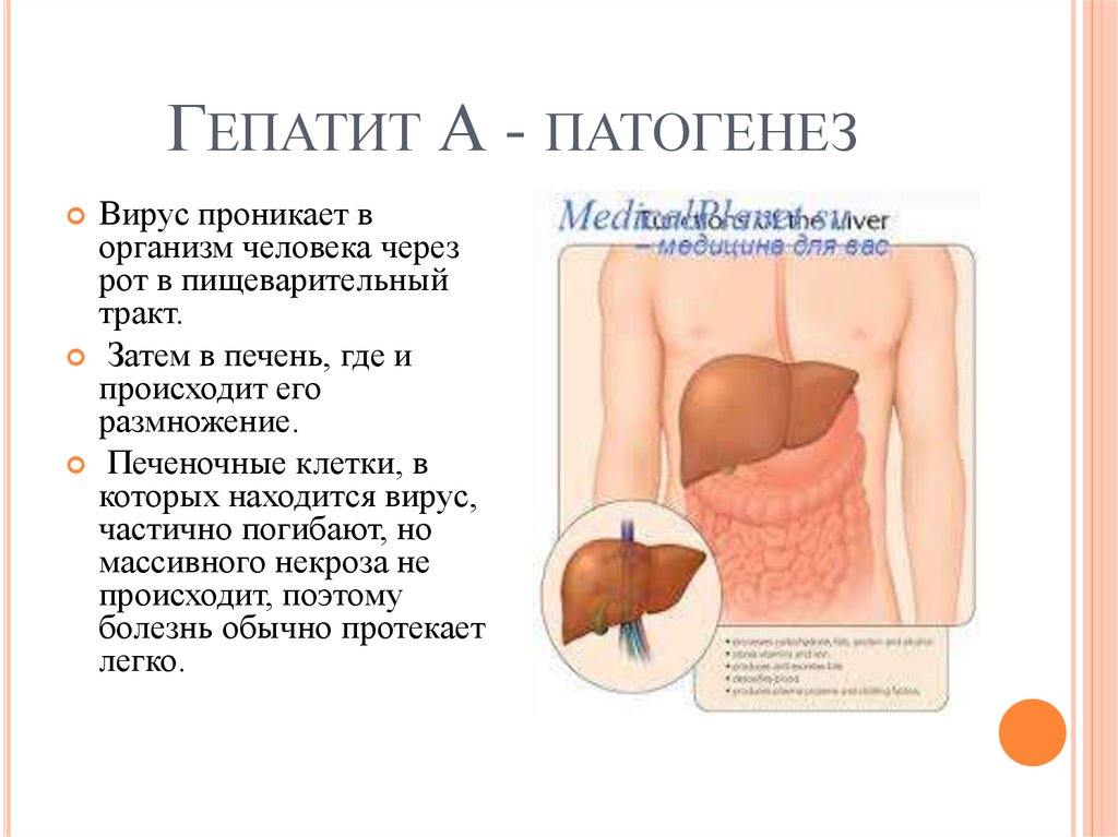 Гепатит f. Патогенез гепатита е схема. Гепатит вирусный гепатит этиология. Патогенез вирусного гепатита в. Вирус гепатита а этиология.