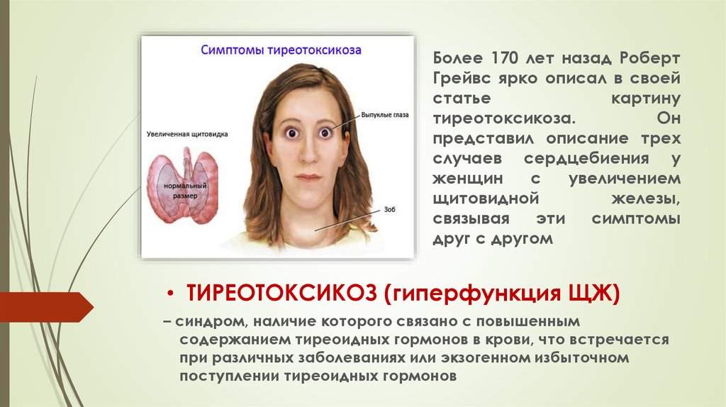 Какие признаки щитовидной железы у женщин. Тиреотоксикоз щитовидной железы. Гипертиреоз щитовидной железы. Щитовидная железа психосоматика. Зоб щитовидной железы психосоматика.