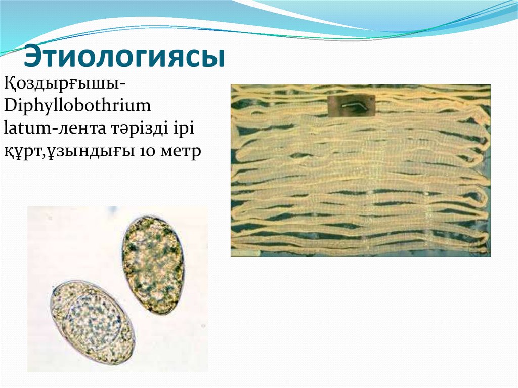 Этиологиясы