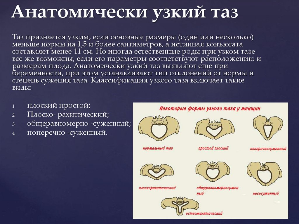 Узкий таз в акушерстве презентация