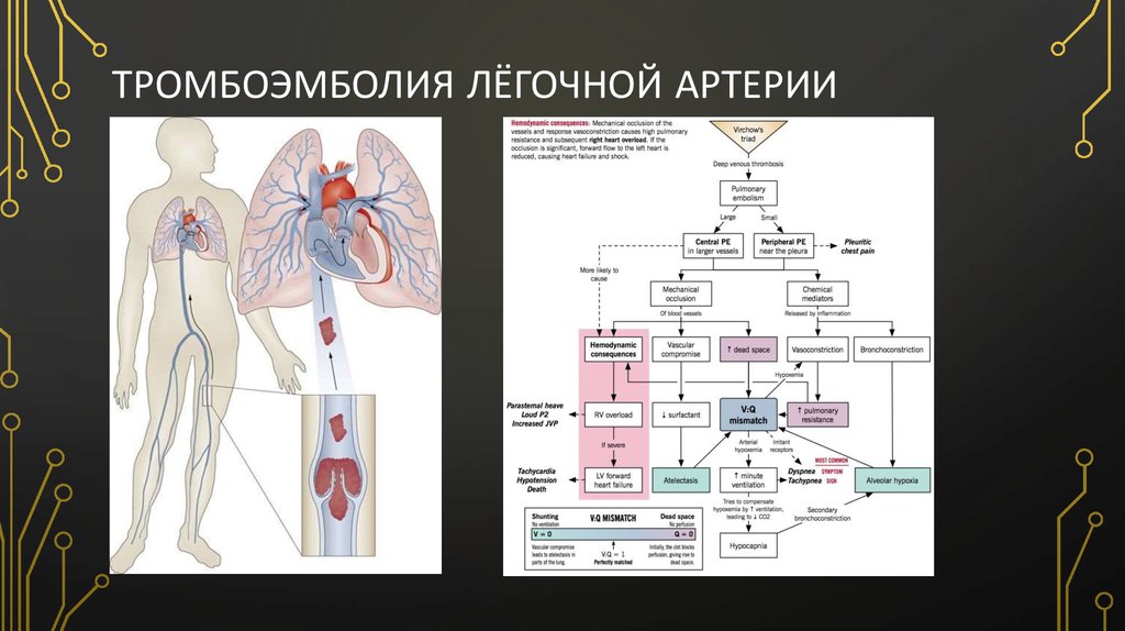 Что такое легочная тромбоэмболия простыми словами. Тромбоэмболия легочной артерии. Тромбоэмболия ветвей легочной артерии клинические рекомендации. Тромбоэмболия легочной артерии причина смерти.
