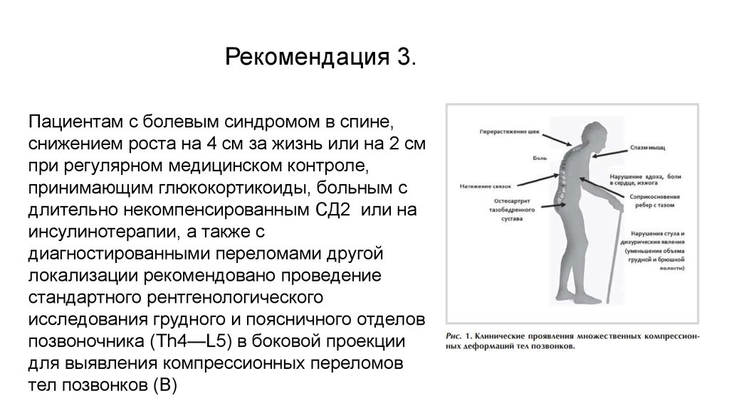 Хронический болевой синдром клинические рекомендации 2024. Рекомендации пациенту с болевым синдромом. Рекомендации для пациентов хронической боли. Рекомендации пациентам с остеопорозом. Рекомендации по ведению пациентов с хронической болью.