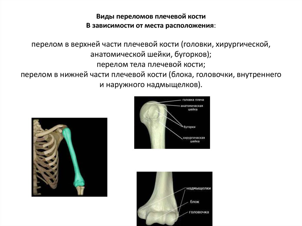 Открытый перелом плечевой кости карта вызова