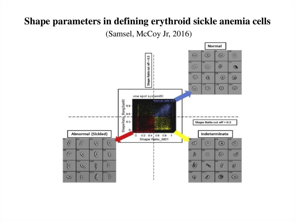 Shape parameters in defining erythroid sickle anemia cells (Samsel, McCoy Jr, 2016)