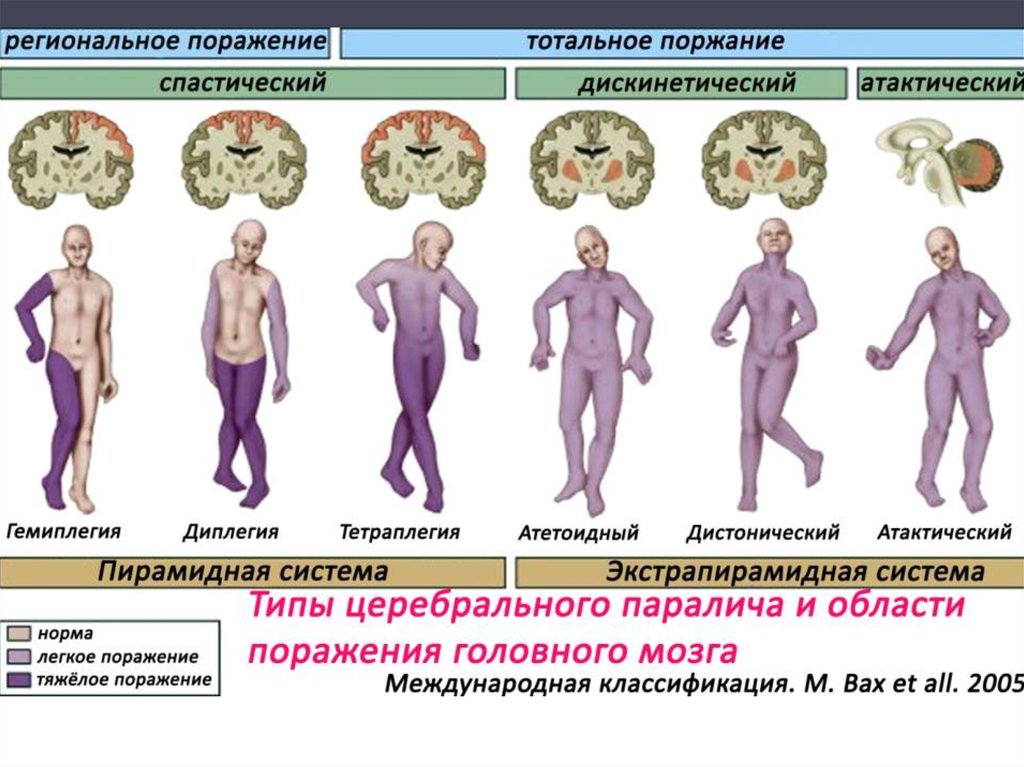 Индивидуальное развитие ребёнка с ДЦП средствами музыкальной деятельности