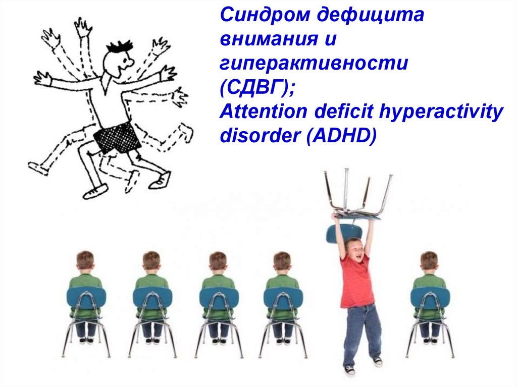 Сдвг на английском. Синдром дефицита внимания и гиперактивности (СДВГ). Дети с синдромом дефицита внимания и гиперактивностью. Синдрому дефицита внимания (СДВГ. Синдром дифицитавнимания.