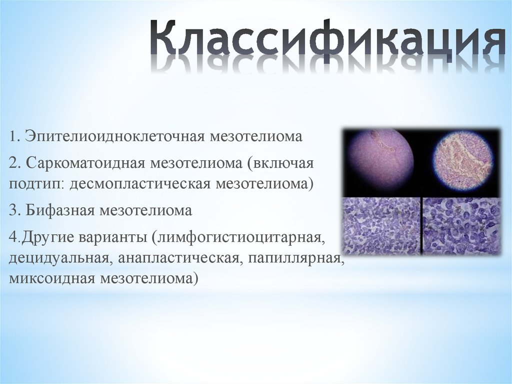 Классификация