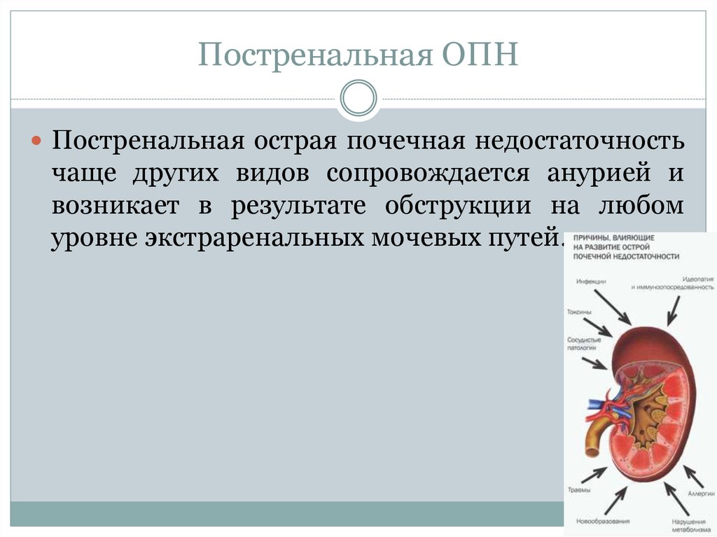 Как происходит почечная недостаточность. Преренальная ренальная и постренальная почечная недостаточность. Постренальная острая почечная недостаточность. Почечная недостаточность ренальная постренальная. ОПН преренальная ренальная постренальная.