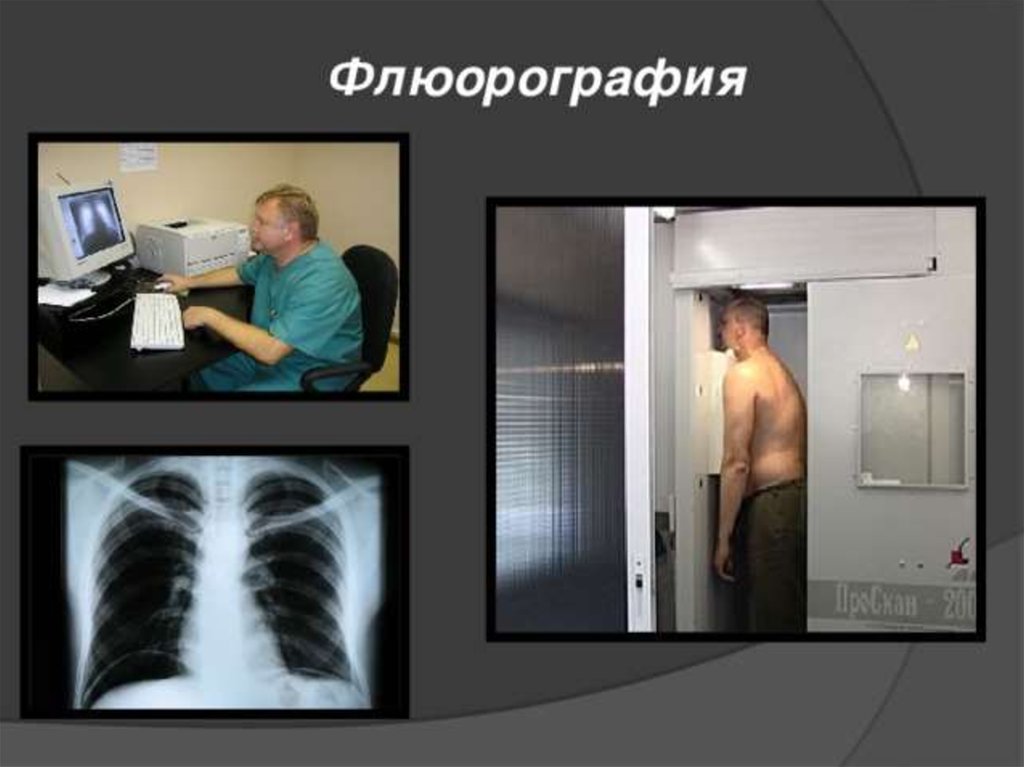 Рентген или флюорография
