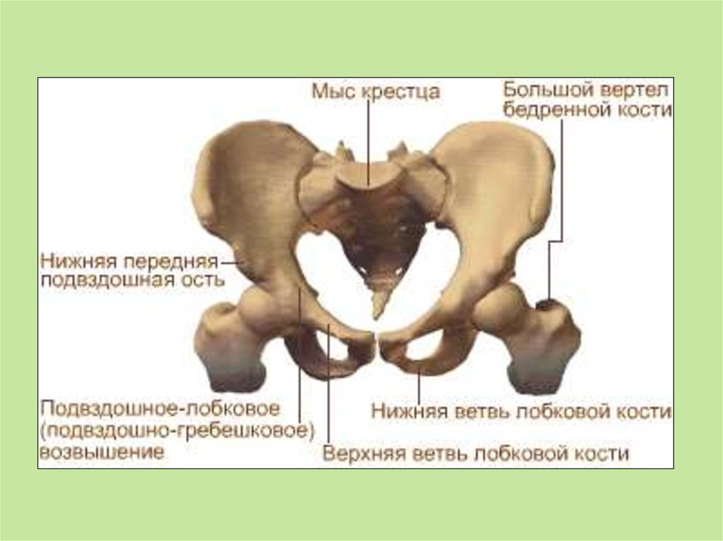 Передняя подвздошная кость