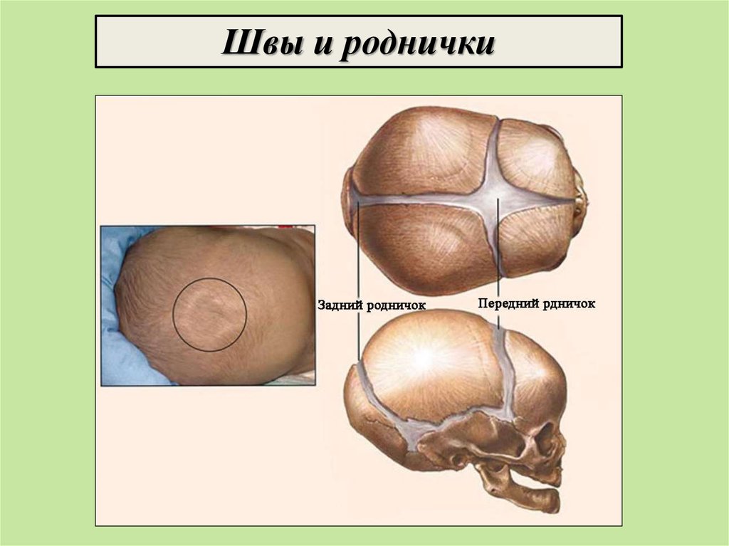 Швы большого родничка. Роднички новорожденного анатомия черепа. Швы и роднички черепа. Швы и роднички черепа новорожденных. Швы черепа плода и роднмчкм.