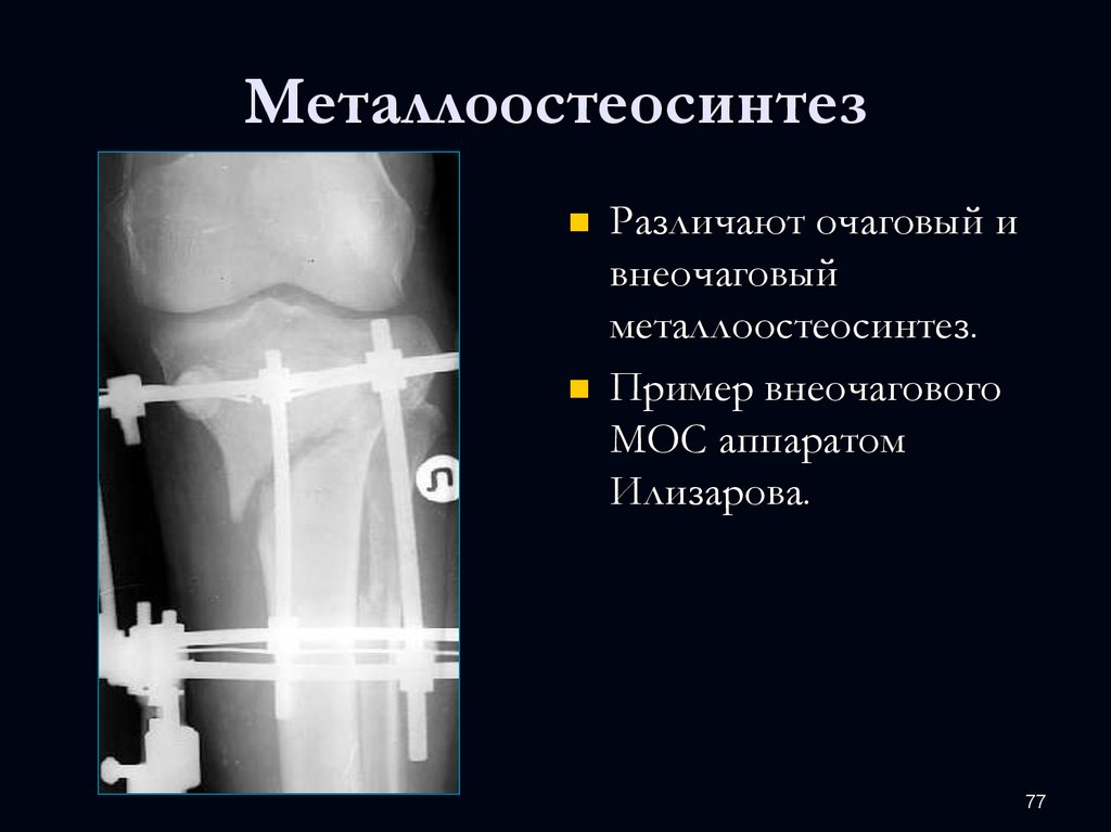 Лучевая анатомия семиотика