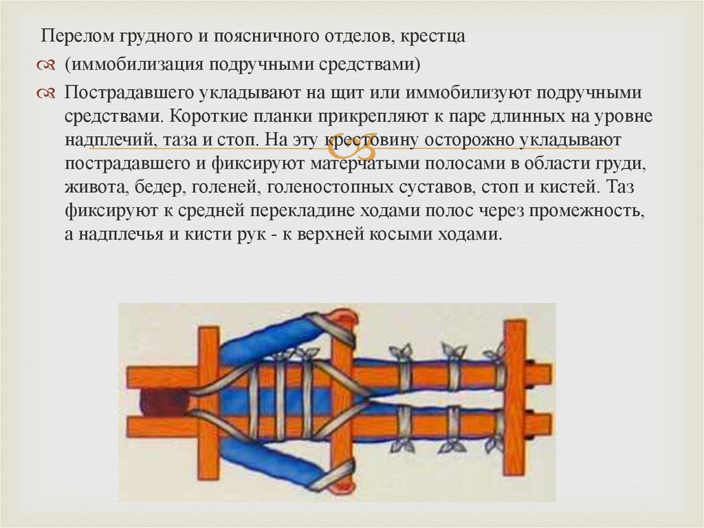 Перелом крестцового позвонка. Иммобилизация при переломе грудного отдела позвоночника. Транспортная иммобилизация при переломе позвоночника. Мобелизация при переломе позвоночника. Иммобилизация при переломе поясничного позвоночника.