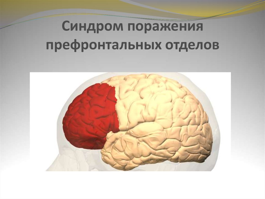 Поражение долей. Префронтальный лобный синдром. Синдром поражения префронтальных отделов мозга. Синдром поражения префронтальных коры лобной доли. Синдромы поражения подкорковых и префронтальных отделов..