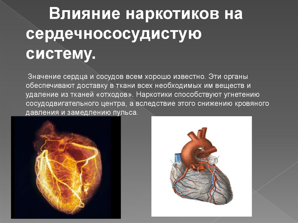 Болезни сердца презентация