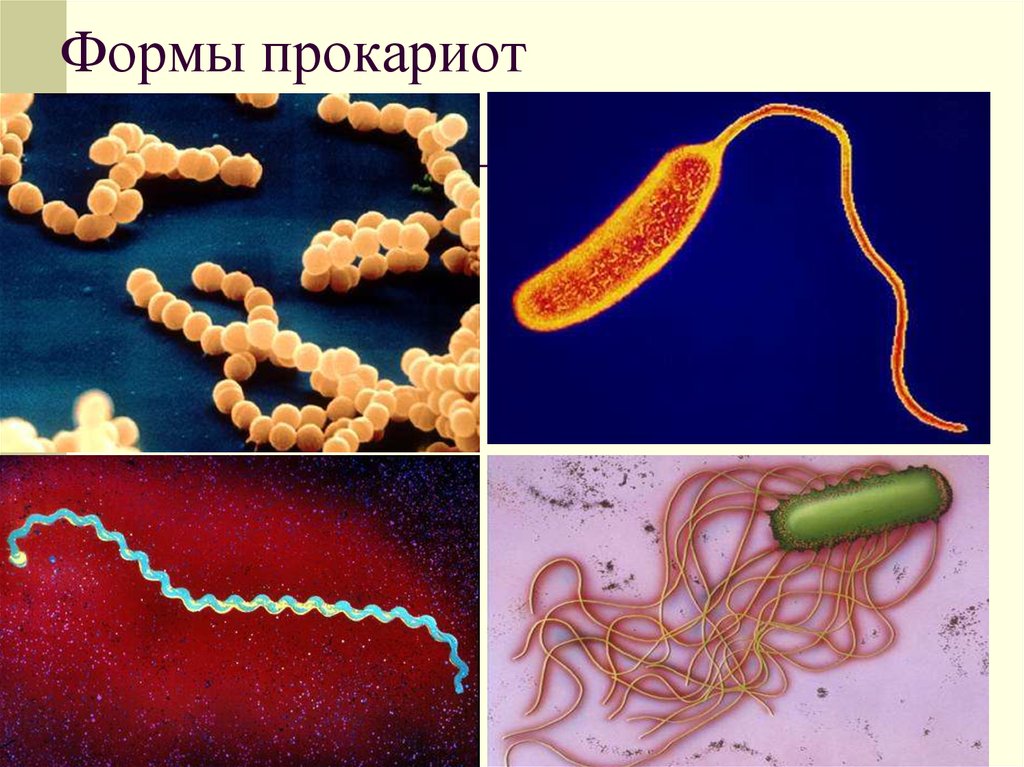Прокариоты 10 класс. Представители микроорганизмов прокариоты. Формы прокариот. Формы бактерий прокариот. Формы клеток прокариот.