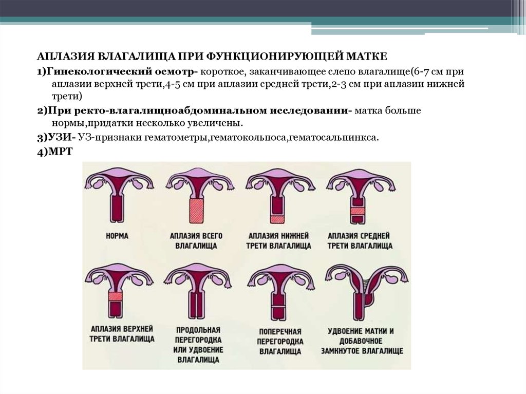 Аномалия развития и положения женских органов презентация