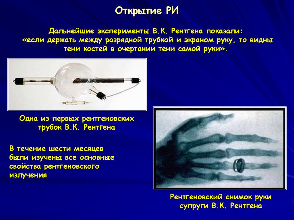 Свойства рентгеновского изображения