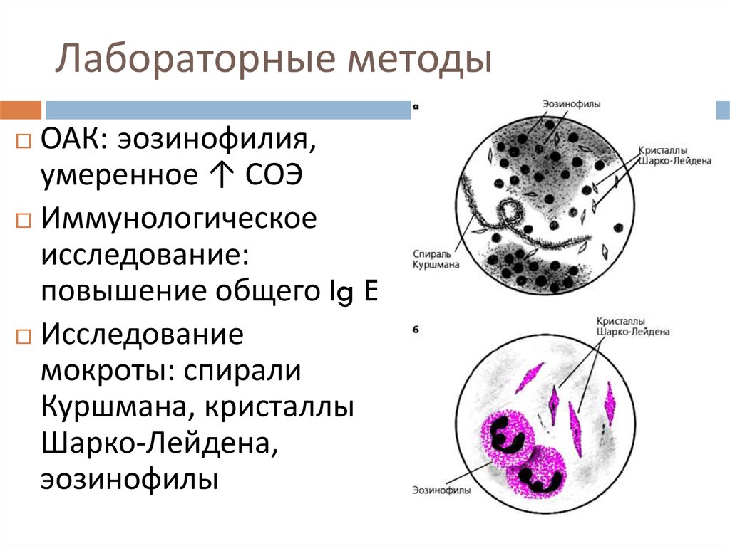 Эластические волокна в мокроте фото