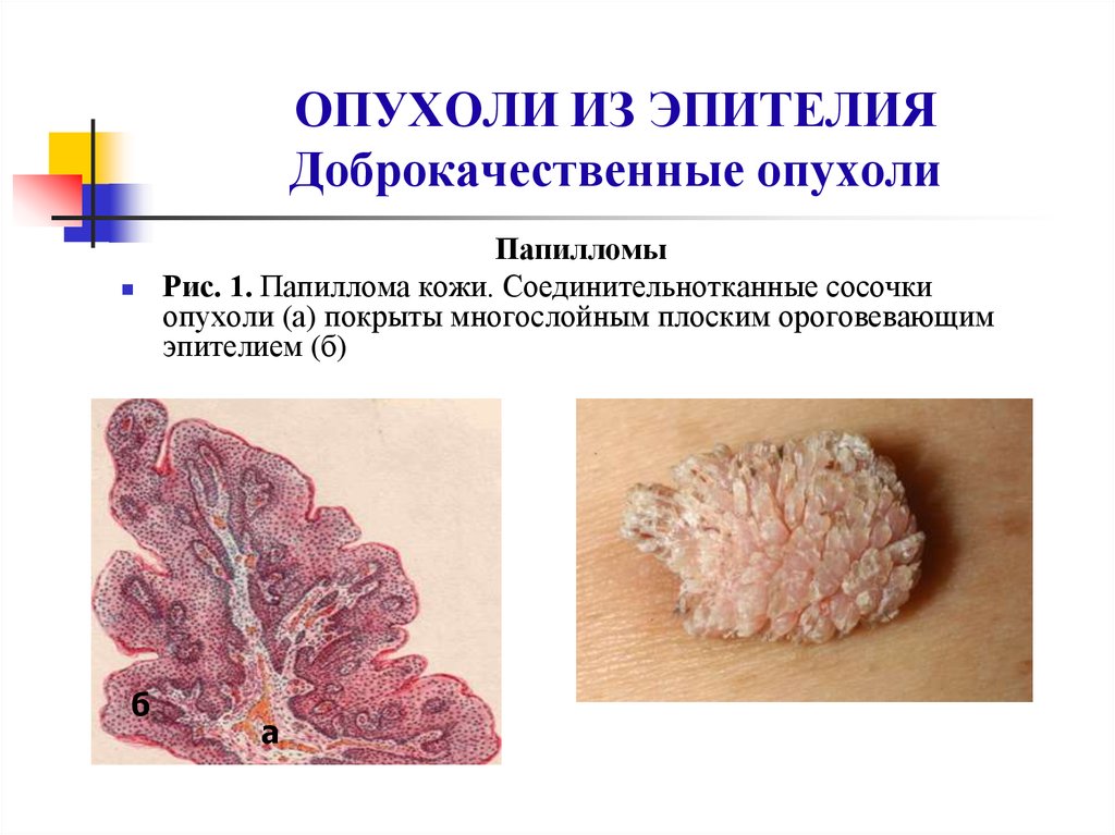 Нейроэндокринные опухоли общие принципы диагностики и лечения руководство