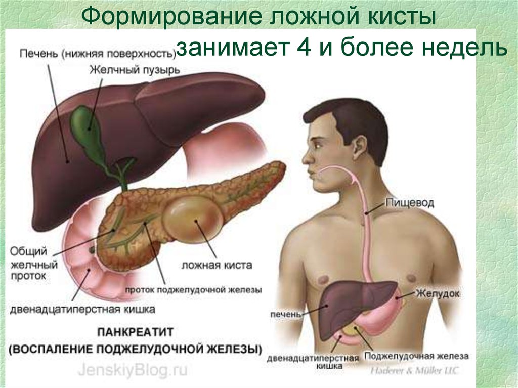 Воспаление поджелудочной железы желчного пузыря. Поджелудочная железа фото. Фото поджелудочной железы у человека. Печень и поджелудочная железа.