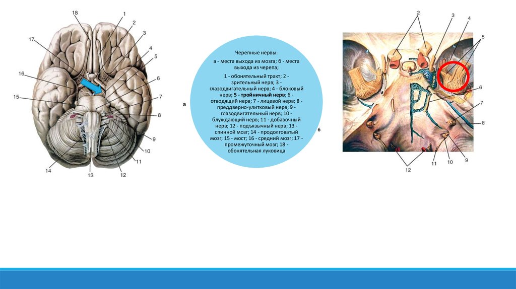 5 6 черепные нервы. Выход 12 пар черепных нервов из мозга. Черепные нервы на основании головного мозга. Место выхода 5 пары черепных нервов. Тройничный нерв выход из мозга и черепа.