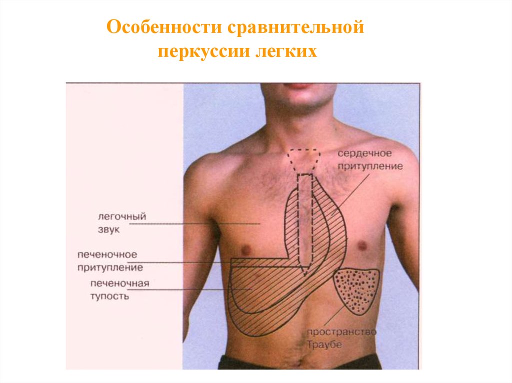 Перкуссия легких презентация