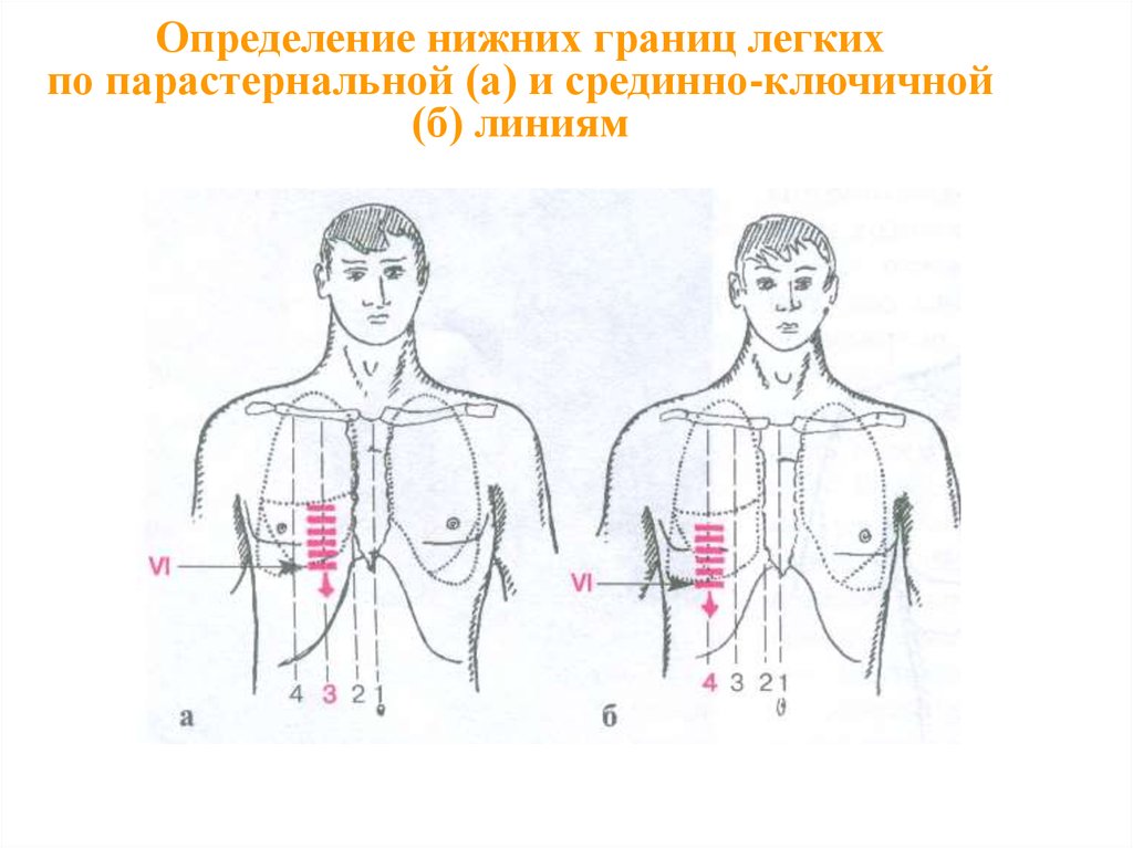 Виды дыхания при аускультации легких схема