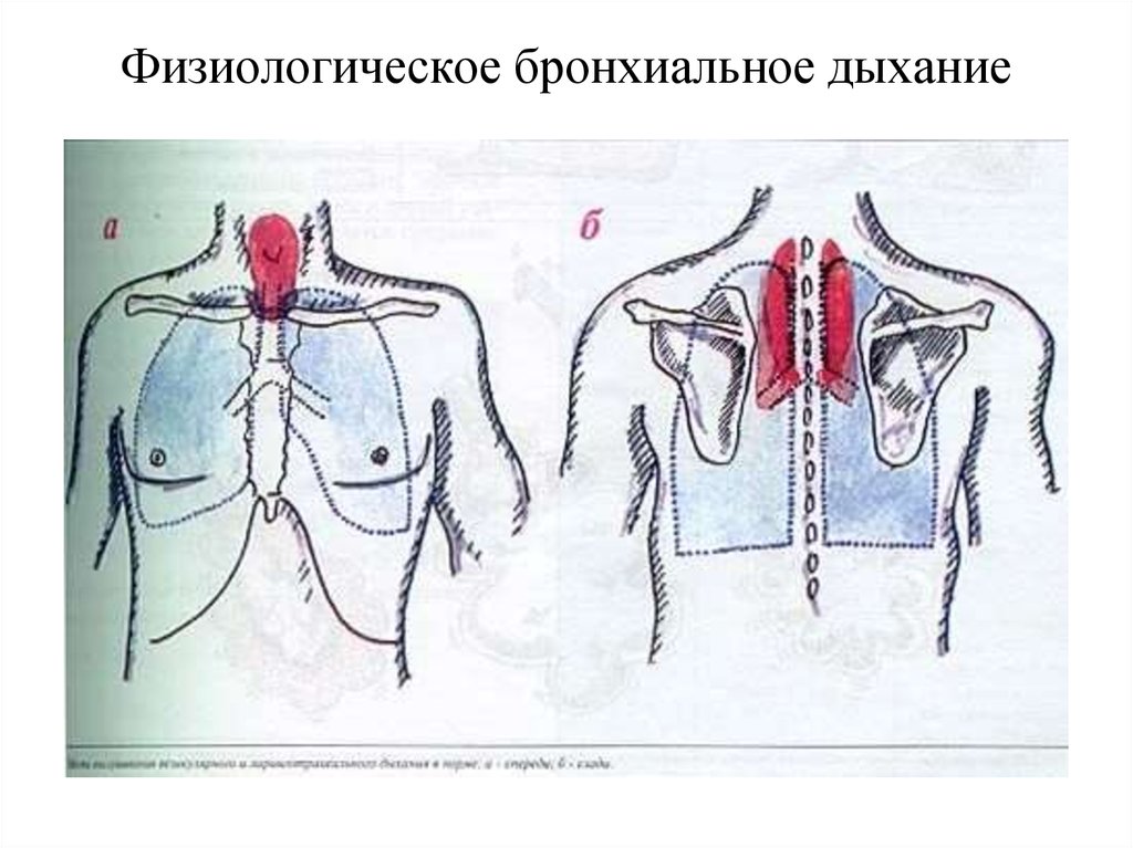 Аускультация легких рисунок