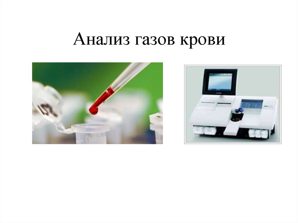 Исследование газов. Исследование газов артериальной крови. Исследование газового состава артериальной крови. Анализ газов крови. Газовый состав крови анализ.