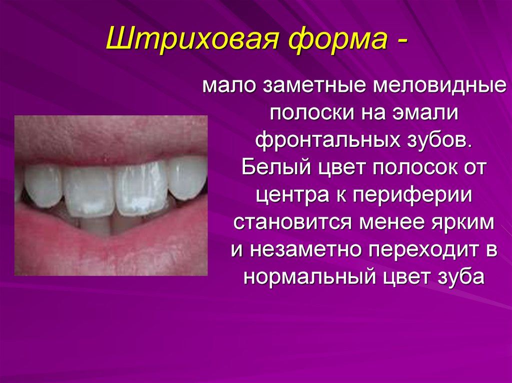 Патология твердых тканей. Некариозные поражения возникающие до прорезывания зубов. Болезни зубов некариозного происхождения классификация. К некариозным поражениям зубов относят. Наследственные некариозные поражения зубов.