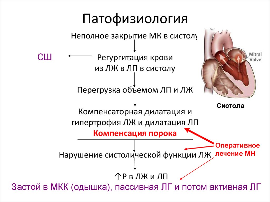 Пороки сердца названия. Митральные пороки сердца. Пороки сердца патофизиология. Пороки сердца классификация. Врожденные пороки сердца патофизиология.