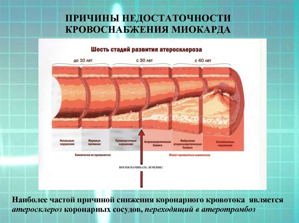 Причины недостаточности кровообращения