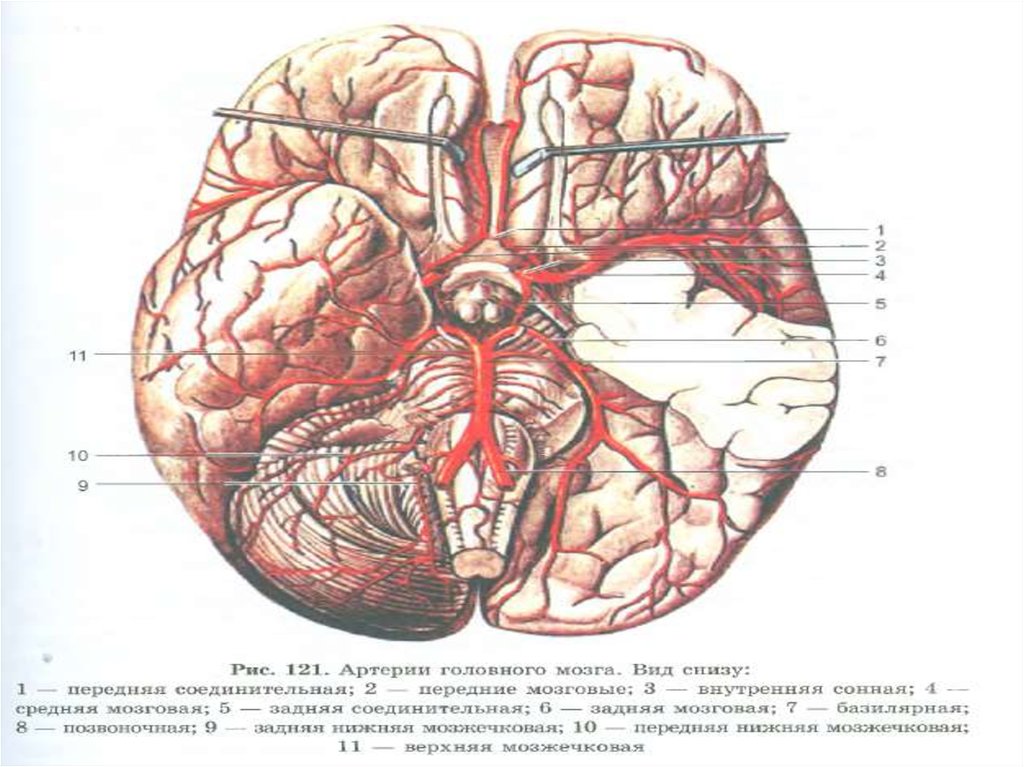 Мозговые артерии латынь. Соединительные артерии головного мозга. Передняя соединительная артерия головного мозга анатомия. Задняя соединительная артерия головного мозга. Ветви средней мозговой артерии анатомия.