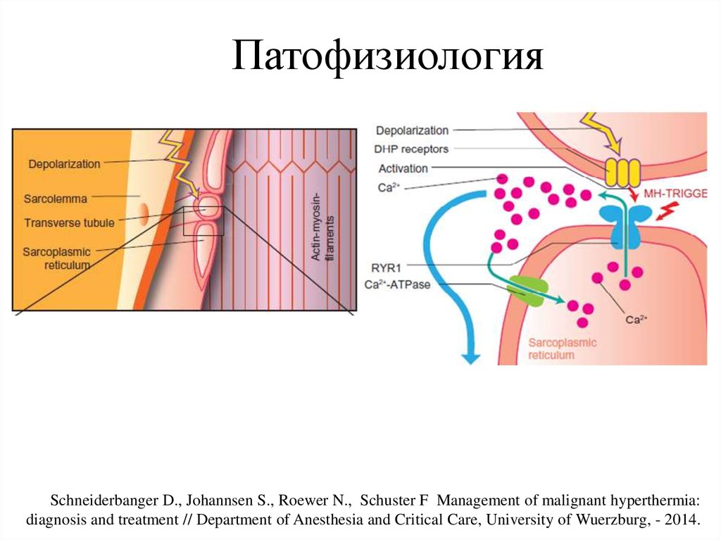 Злокачественная гипертермия презентация