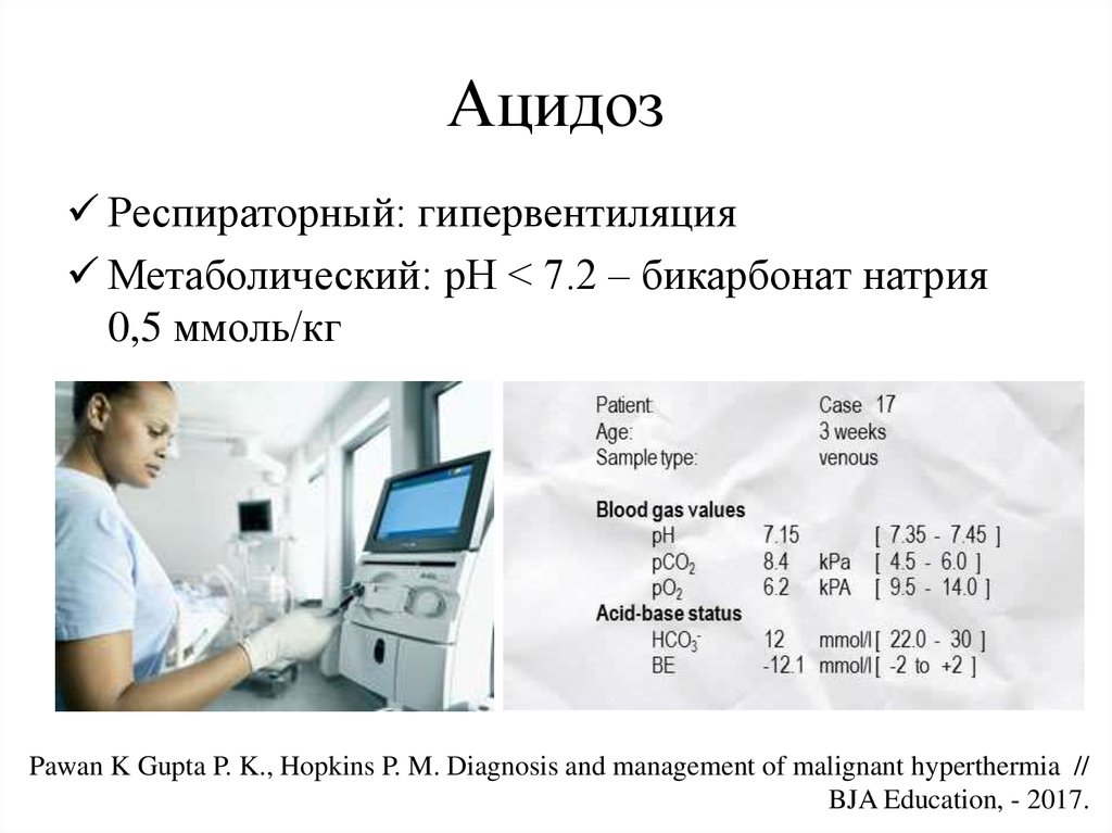 Злокачественная гипертермия презентация