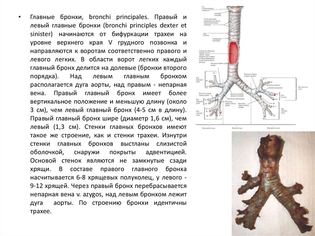 На каком уровне бифуркация трахеи